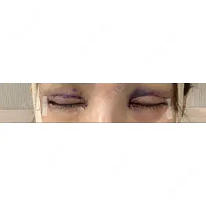 RG整形外科（旧リオン整形外科）口コミ