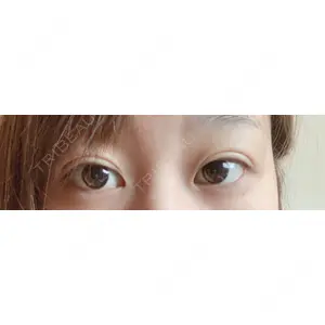口コミ
