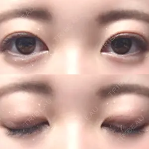 口コミ