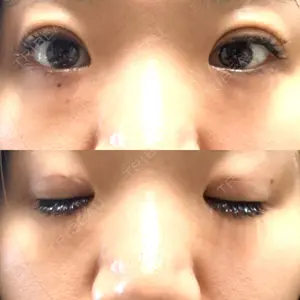 口コミ