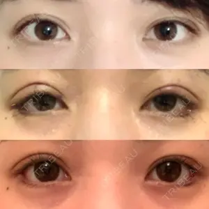 プロミス整形外科口コミ
