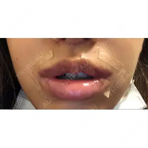 清潭女神美容外科の