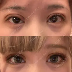 中央クリニック 大阪梅田中央クリニック美容外科口コミ