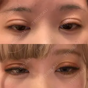 中央クリニック 大阪梅田中央クリニック美容外科口コミ