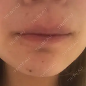 B-LINE CLINIC B-LINE CLINIC 池袋院口コミ