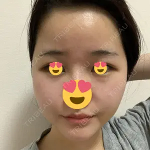 ボンディ美容整形外科（旧リオン整形外科）口コミ