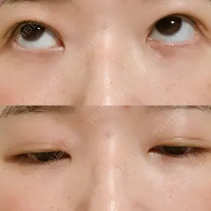 湘南美容クリニック 湘南美容クリニック 東京蒲田院口コミ