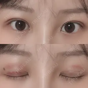 RG整形外科（旧リオン整形外科）口コミ