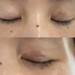 湘南美容クリニック 湘南美容クリニック 柏院口コミ