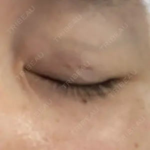 湘南美容クリニック 湘南美容クリニック 柏院口コミ