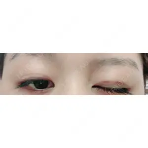 口コミ