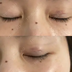 湘南美容クリニック 湘南美容クリニック 柏院口コミ