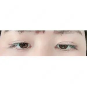 口コミ
