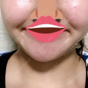 口コミ