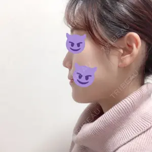 ボンディ美容整形外科（旧リオン整形外科）口コミ