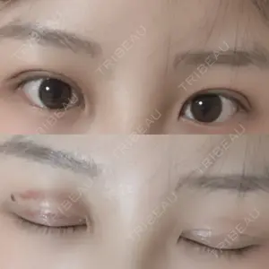 RG整形外科（旧リオン整形外科）口コミ