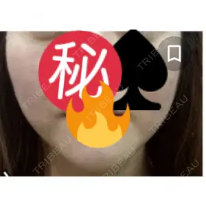 口コミ