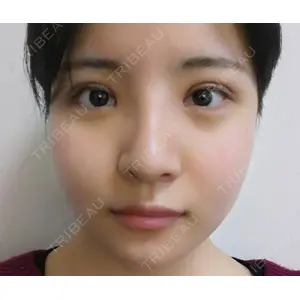 ボンディ美容整形外科（旧リオン整形外科）口コミ