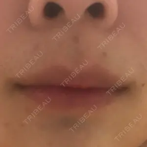 B-LINE CLINIC B-LINE CLINIC 池袋院口コミ