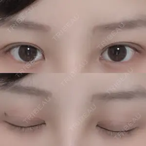 RG整形外科（旧リオン整形外科）口コミ