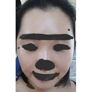 ボンディ美容整形外科（旧リオン整形外科）口コミ