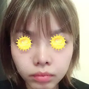 口コミ