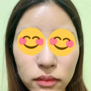 口コミ