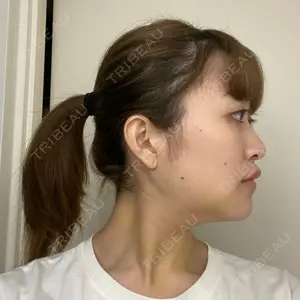 ボンディ美容整形外科（旧リオン整形外科）口コミ