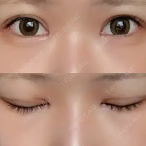 口コミ