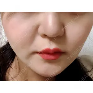 口コミ