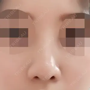 口コミ