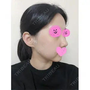 クッキー整形外科の