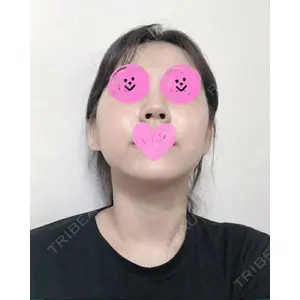 クッキー整形外科の