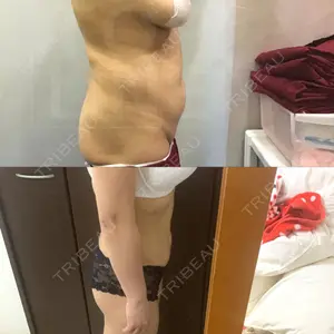 狎鴎亭トップライン医院口コミ