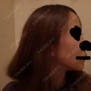 ボンディ美容整形外科（旧リオン整形外科）口コミ