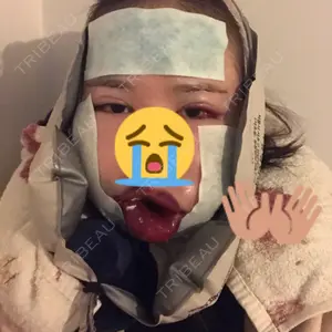 ボンディ美容整形外科（旧リオン整形外科）口コミ