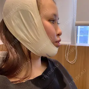 id美容外科の口コミ