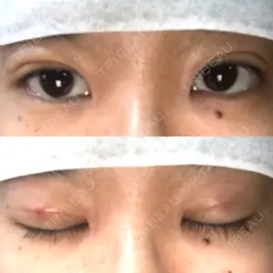 湘南美容クリニック 湘南美容クリニック 大阪京橋院口コミ