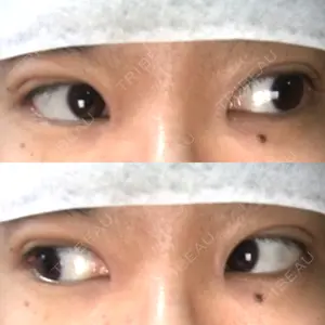 湘南美容クリニック 湘南美容クリニック 大阪京橋院口コミ