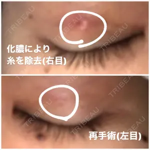 湘南美容クリニック 湘南美容クリニック 大阪京橋院口コミ