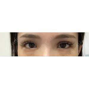 RG整形外科（旧リオン整形外科）口コミ