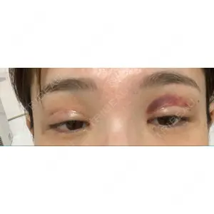 RG整形外科（旧リオン整形外科）口コミ