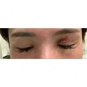 RG整形外科（旧リオン整形外科）口コミ