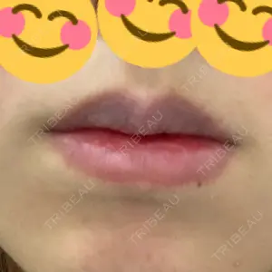 B-LINE CLINIC B-LINE CLINIC 池袋院口コミ