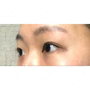 Lovelyan整形外科口コミ