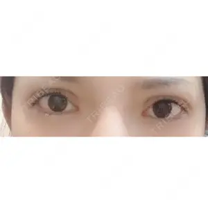 RG整形外科（旧リオン整形外科）口コミ