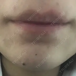 B-LINE CLINIC B-LINE CLINIC 池袋院口コミ