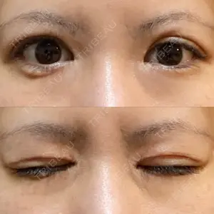 RG整形外科（旧リオン整形外科）口コミ