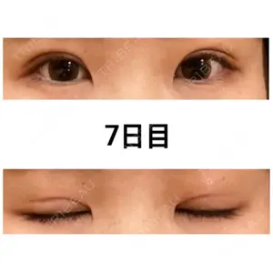 口コミ