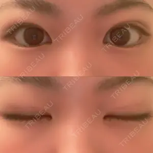 口コミ